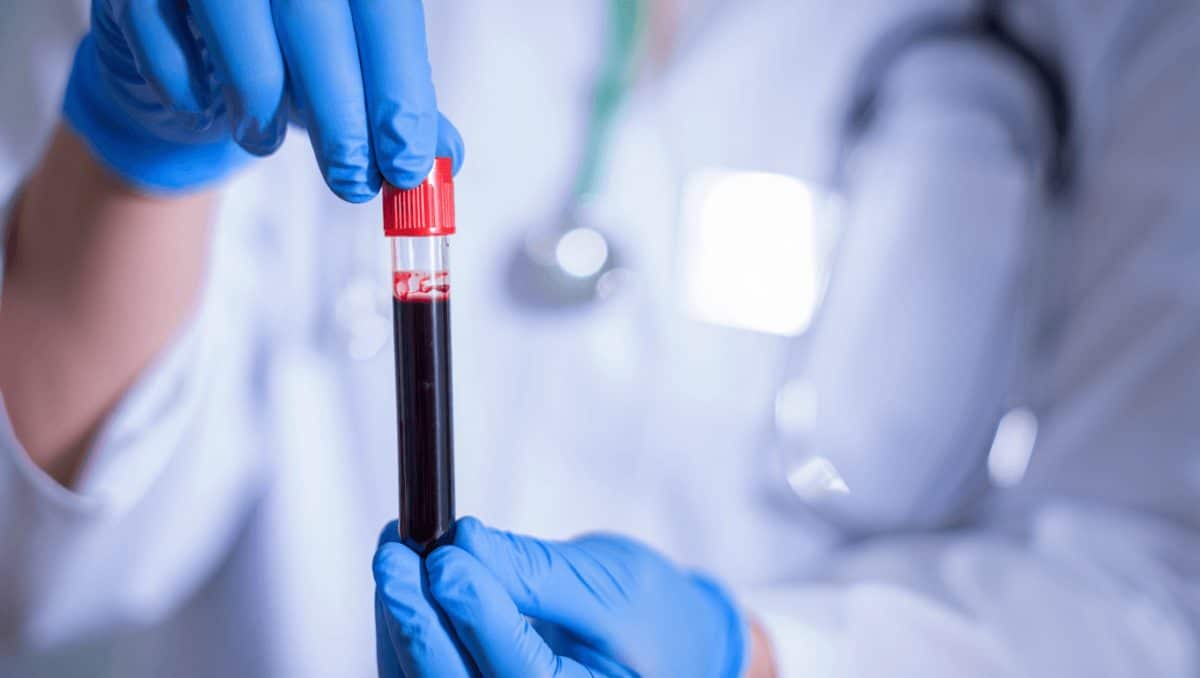 New blood test detects 90% of aggressive prostate cancer cases, beating current screenings