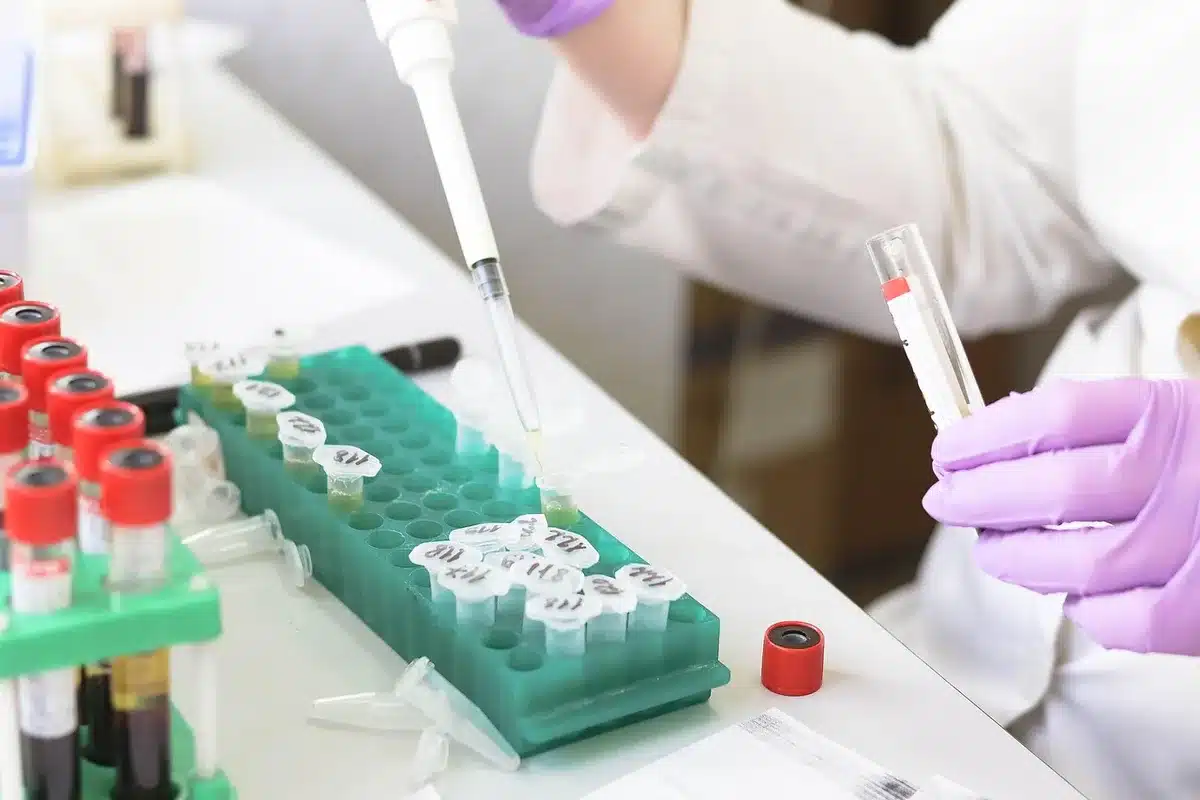 Technician preparing blood samples in a clinical trial setting