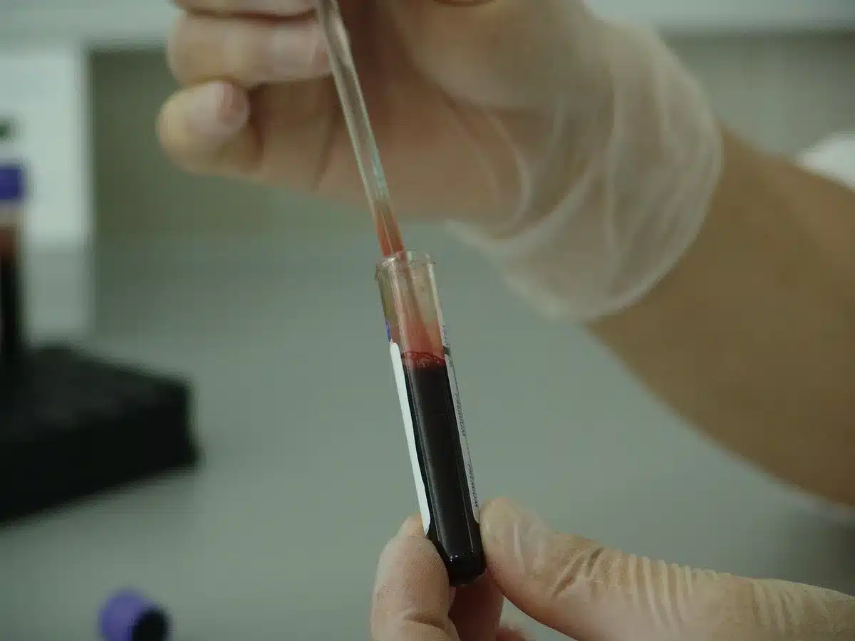 Technician handling flu test vials in a clinical lab