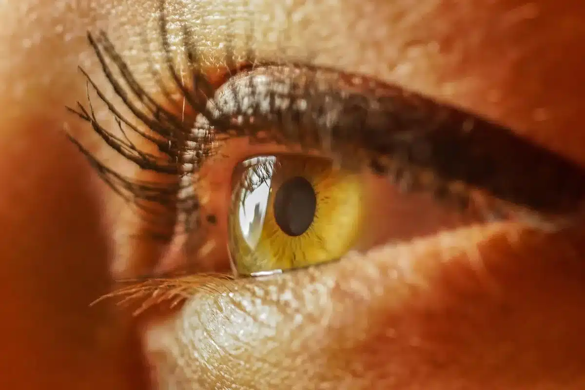 Ophthalmologist reviewing optic nerve scan in clinic